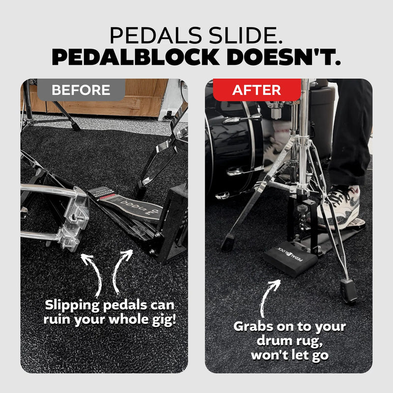 Load image into gallery viewer, Bloqueur de pédale PedalBlock